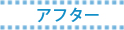 アフター
